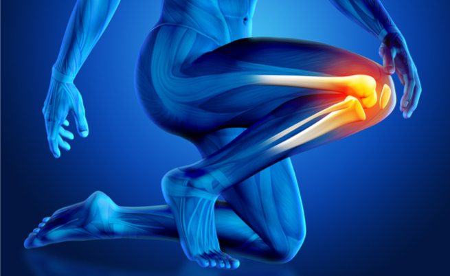 L’Artrosi al ginocchio: limiti funzionali e rimedi